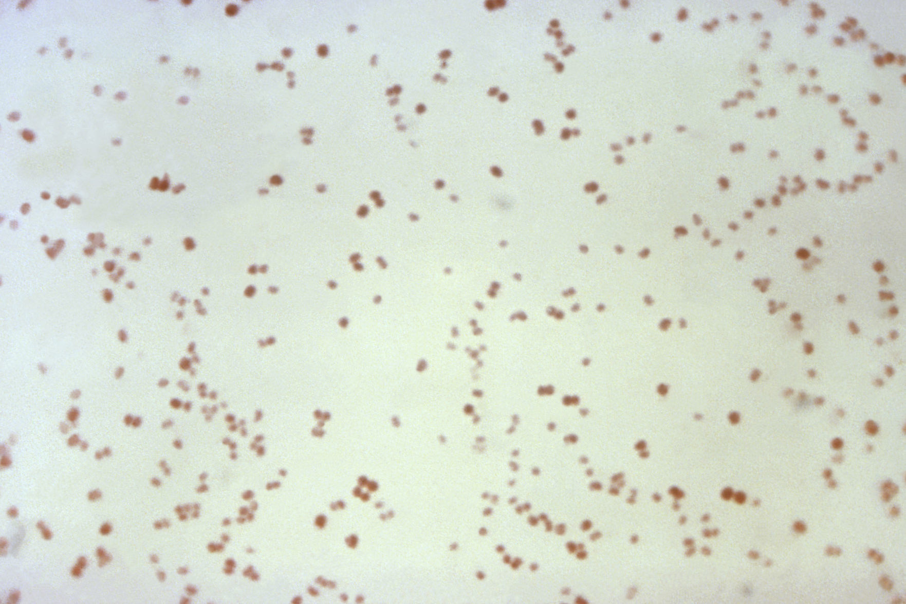 Superbugs